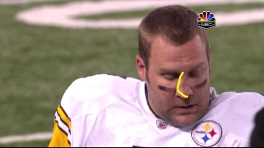 big-ben-broken-nose.jpg